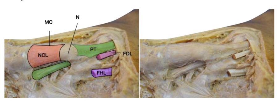 Mason Figure 3.jpg