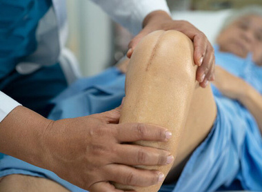 Recent media coverage of NexGen knee implant image