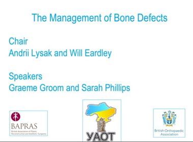 Management of bone defects image
