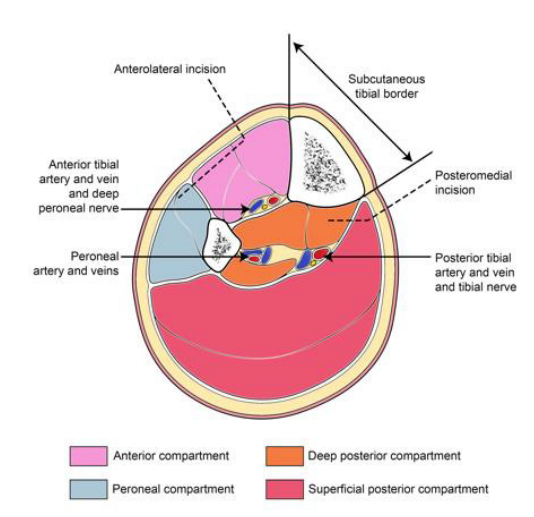 BOAST Open Fractures 2.png