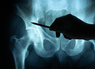 Medical Devices Outcomes Registry (MDOR) image