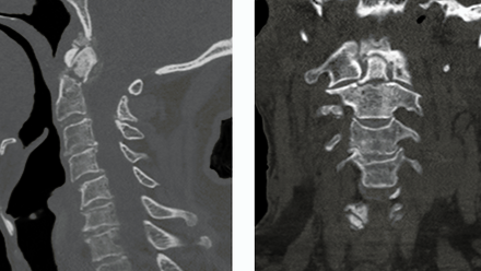 figure 2 odentoid.png