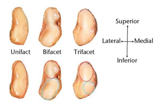 Mason Figure 2.jpg