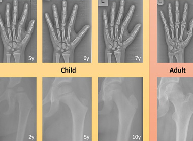 The role of data representation for the design, development and evaluation of (medical imaging) AI innovations in healthcare image