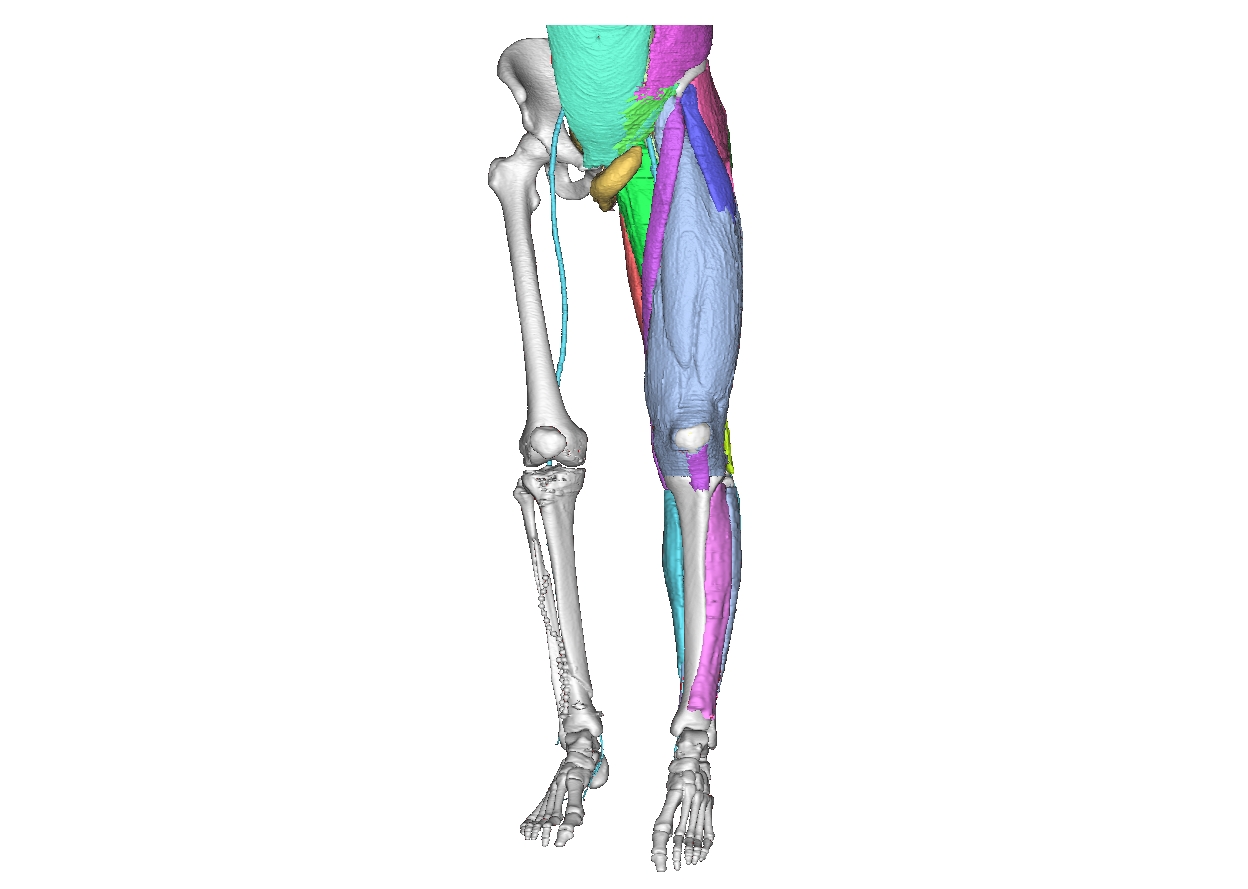 Figure 4 Anatomical 3D Modelling.jpg