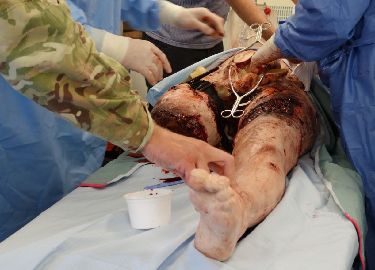 Figure 5 Simulated Blast Injury from IED.JPG