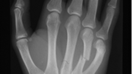 x-ray 1.png