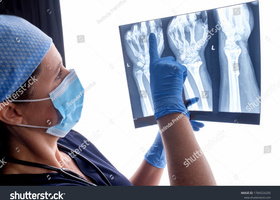 stock-photo-orthopaedic-surgeon-studying-a-x-ray-of-a-broken-radius-bone-in-theatre-after-correctional-surgery-1784524205.jpg