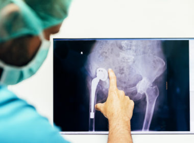 Patient Statement regarding NJR and Implants image