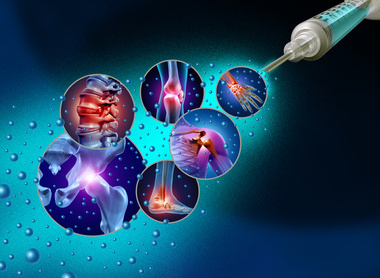 Orthobiologics image