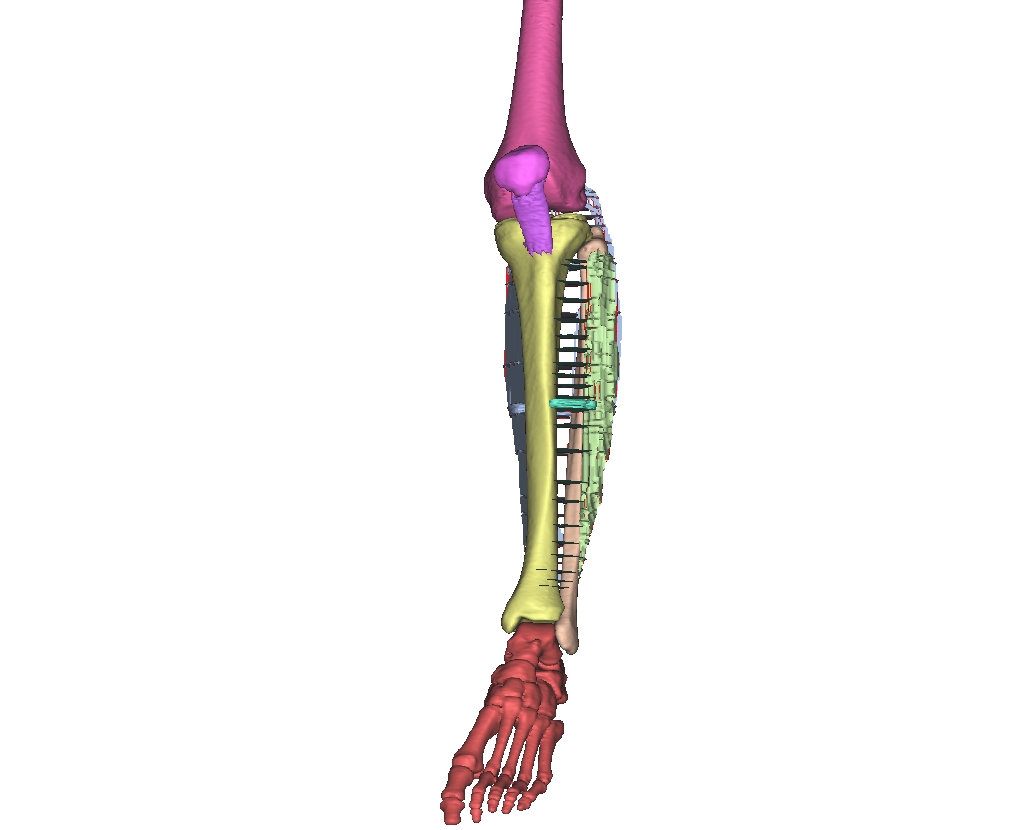 Figure 3 Initial data Segmentation showing individual layers selected from CT images.jpg
